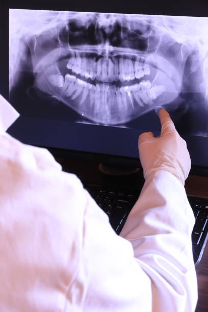 Best Mobile Emergency Dentist in Snohomish, WA